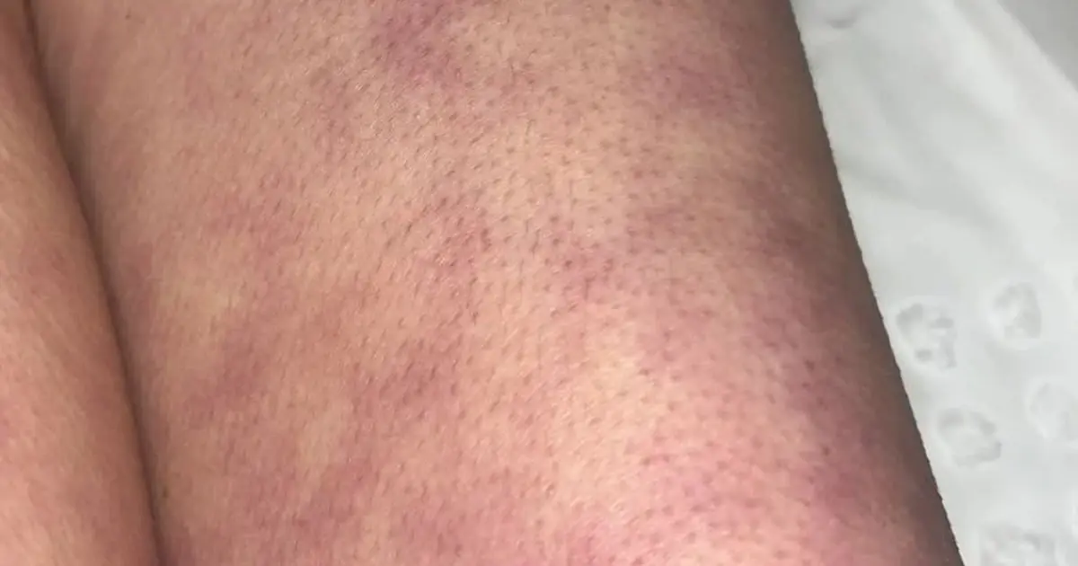 These are the consequences of sleeping with the... See more