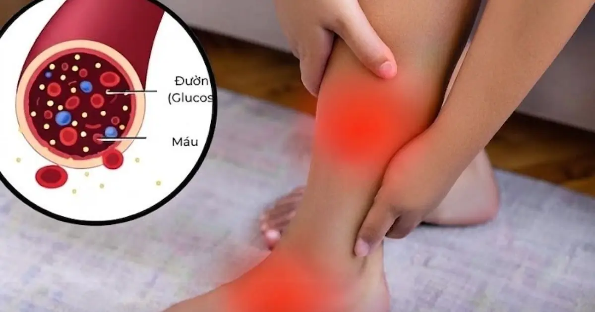 How to Recognize Low Bl00d Sugar: 12 Possible Warning Signs...