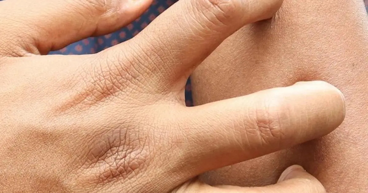 The 9 Types of Persistent Itching That May Be Warning Signs of Serious Health Problems