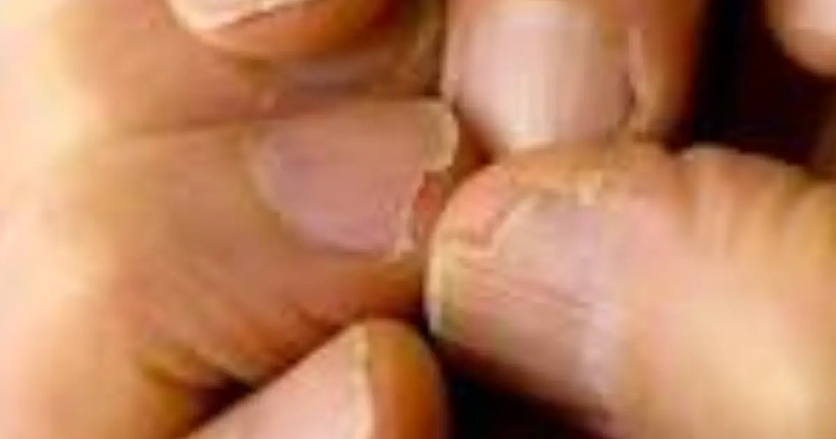 Weak or Cracked Nails Aren’t Always Just Cosmetic…  Here’s What Your Body May Be Trying to Tell You
