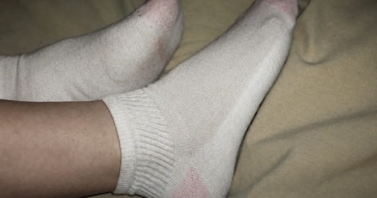 Here’s What Really Happens When You Sleep with Socks On