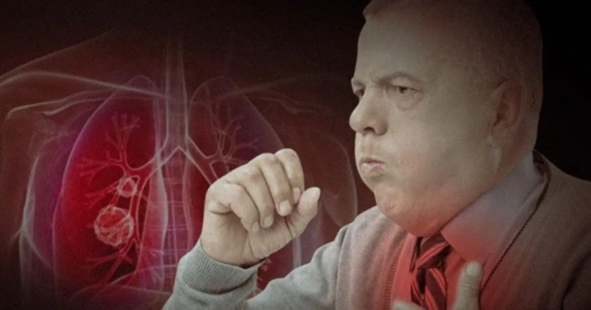 Struggling With Phlegm? 10 Ways to Clear Mucus From Your Chest and Throat