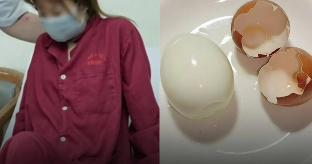Trying to Lose Weight, She Ate Eggs at Every Meal for 5 Months. Her Medical Checkup Left Doctors Stunned