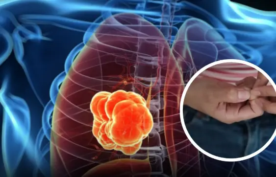 When most people think of stroke, they often picture an older adult