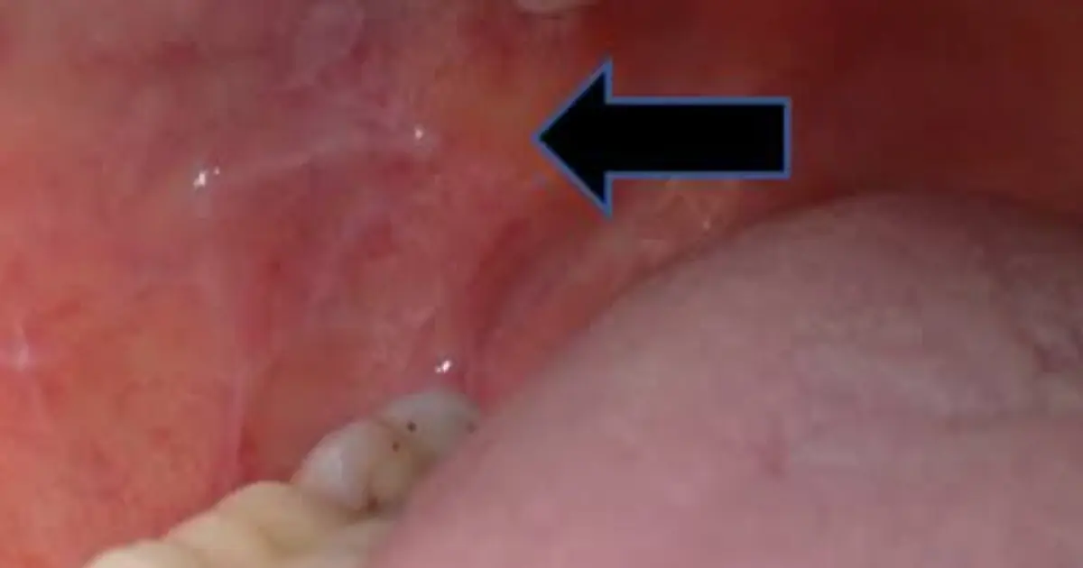 Your Mouth May Reveal More About Your Health Than You Think—Watch for These Signs