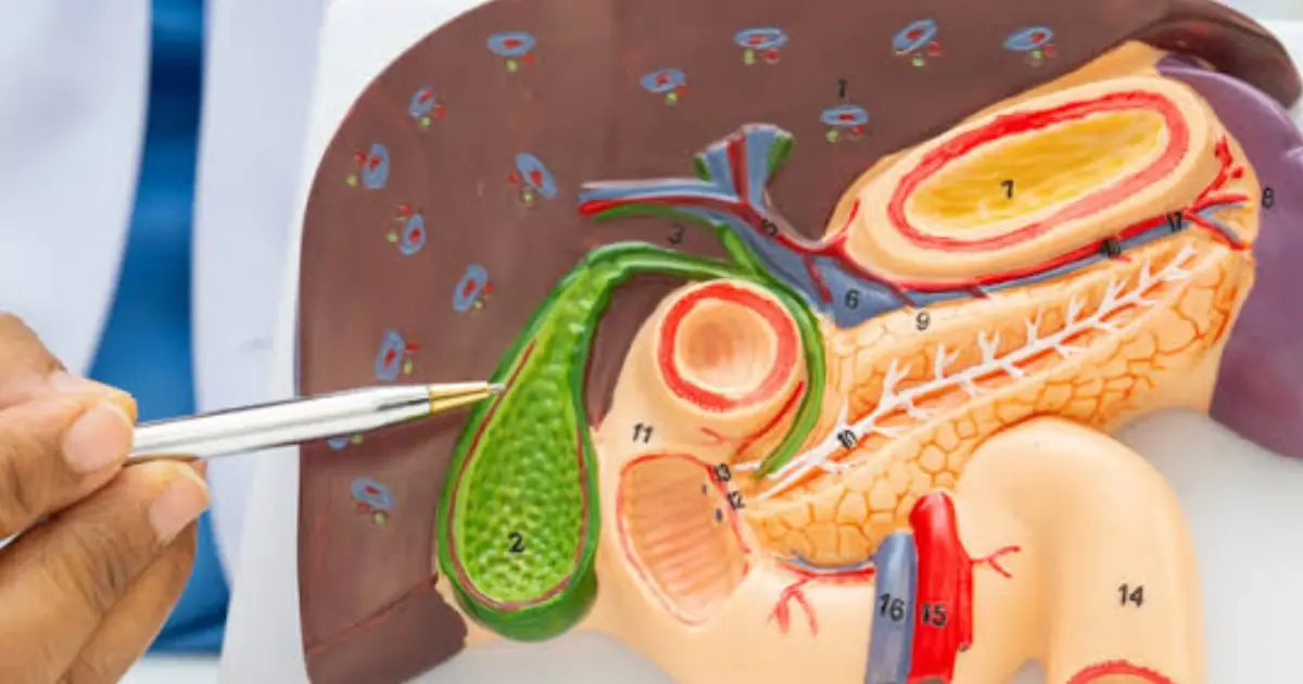No Gallbladder? Here’s How Your Body Adjusts After Surgery - and What to Watch For