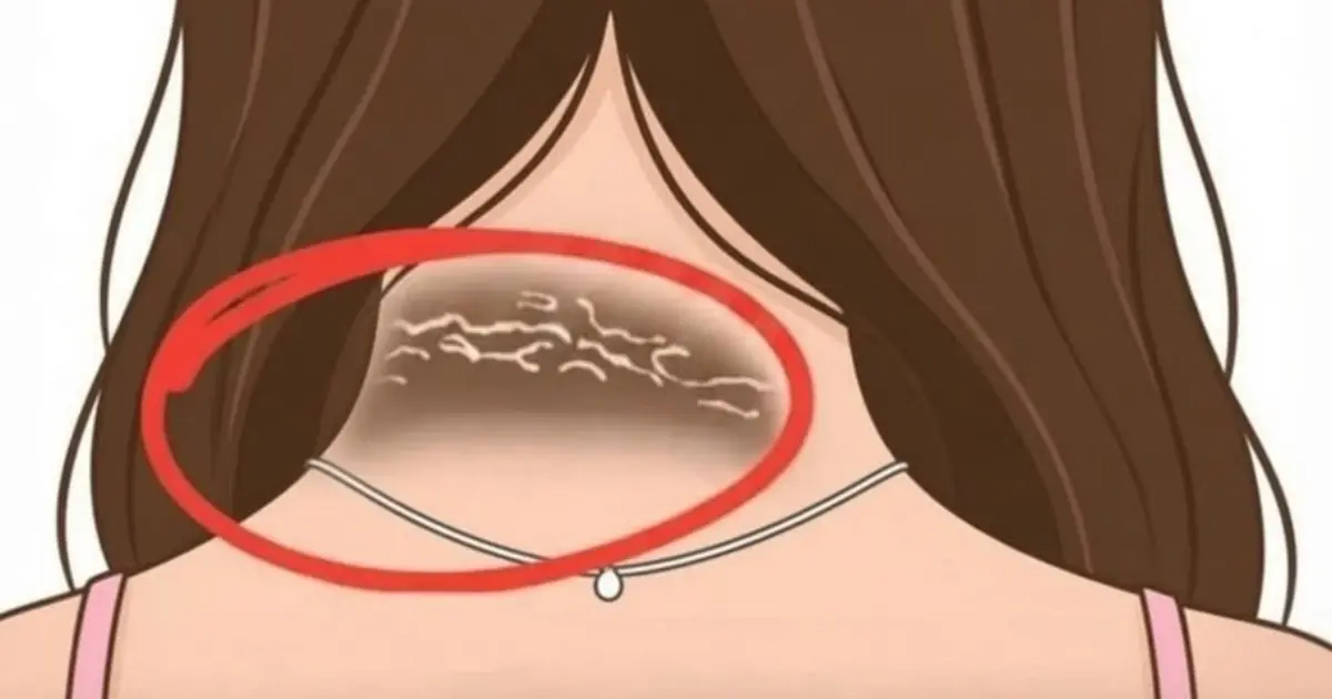 Could Your Skin Be Warning You About Diabetes? Here Are 12 Signs to Know...