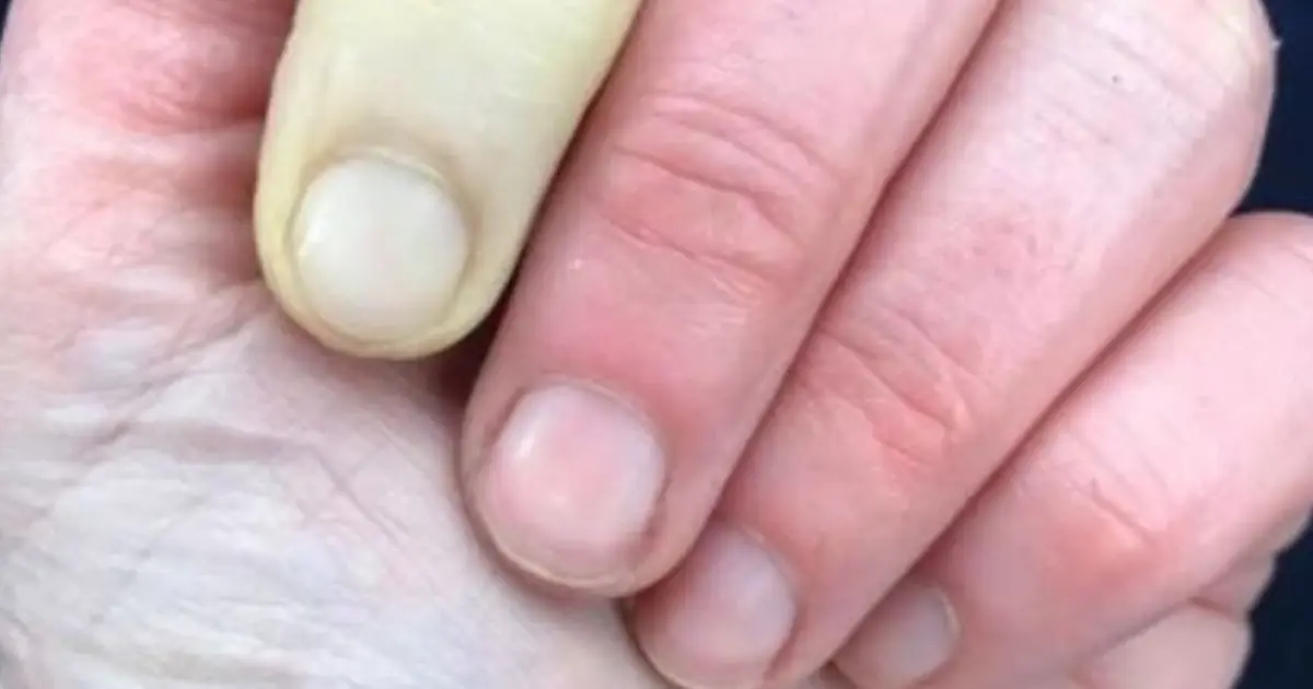 The Midnight Chill: Why You Might Wake Up with a Pale, Numb Finger (And How to Gently Restore Warmth and Circulation)