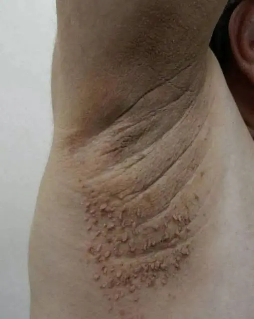 These Could Be the First Warning Signs Your Body Is Sending
