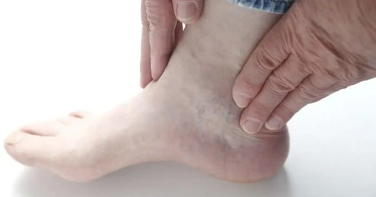 Diabetes Warning Signs: 12 Changes Your Body May Be Showing