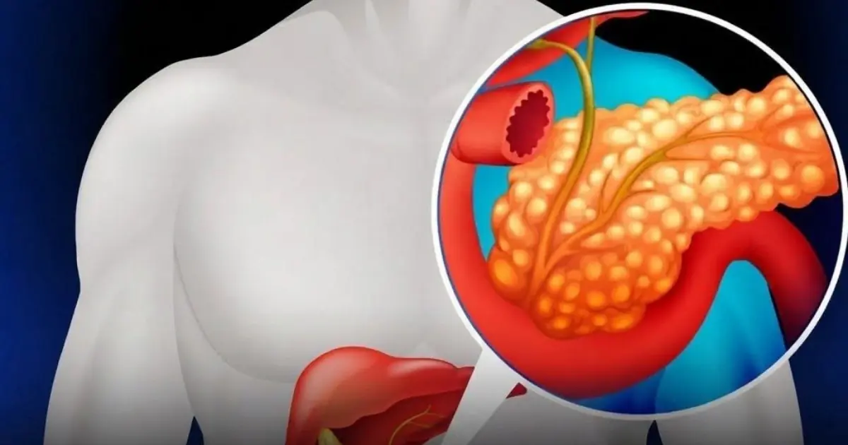 11 Symptoms That May Be Associated With Pancreatic Can.cer...