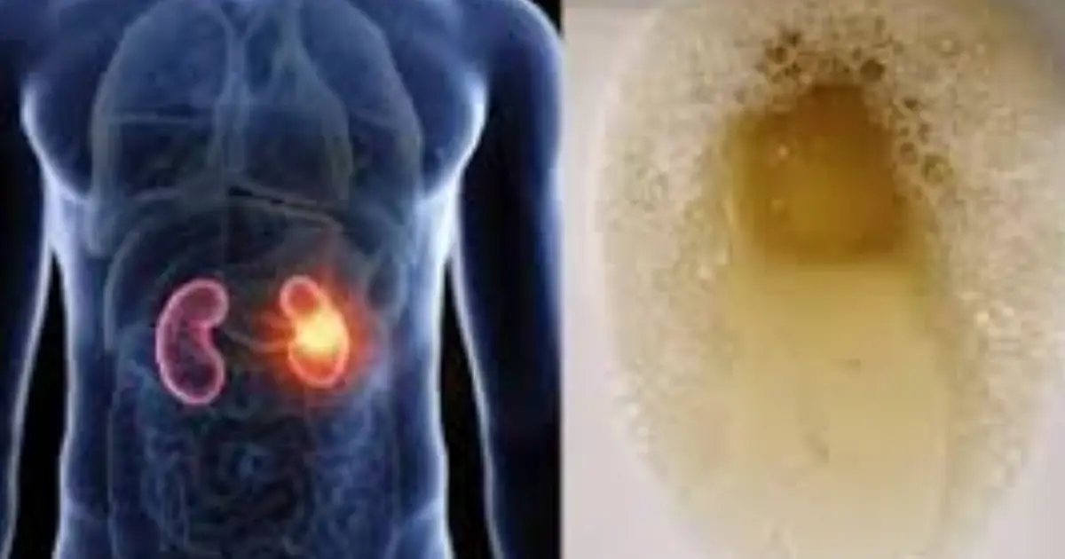 If Your Urine Looks Foamy, Here’s What Your Body May Be Trying to Tell You
