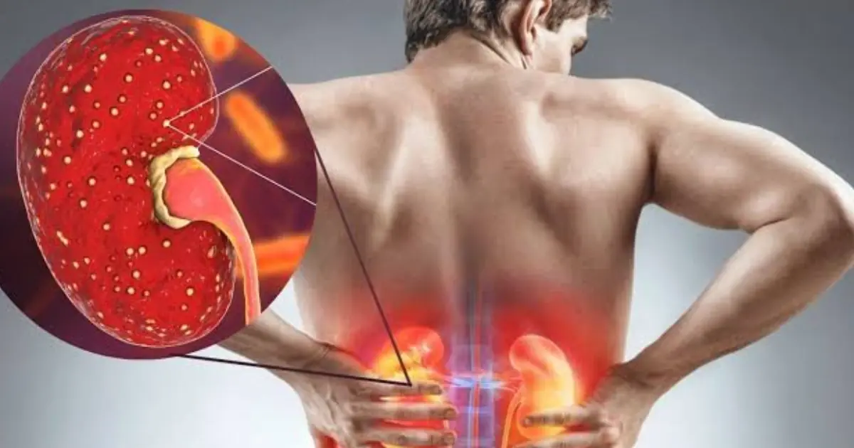 Don’t Ignore These 23 Unusual Symptoms — They Could Be Linked to Kidney Disease