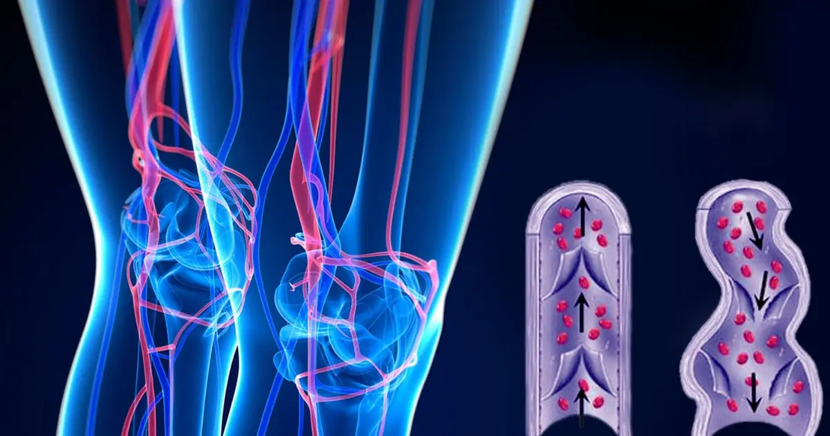 Want to Support Better Circulation? Don’t Overlook These 6 Everyday Habits