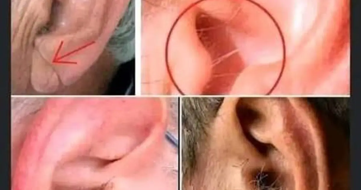 Ear Hair and Aging: Why Hair Growing on Your Ears Is Usually Nothing to Worry About