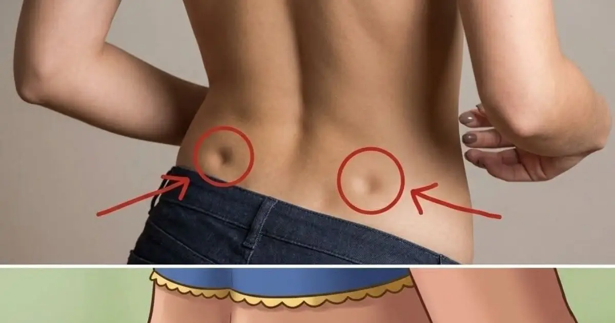 If you have these two holes in your back, it means you don’t…😱 👇