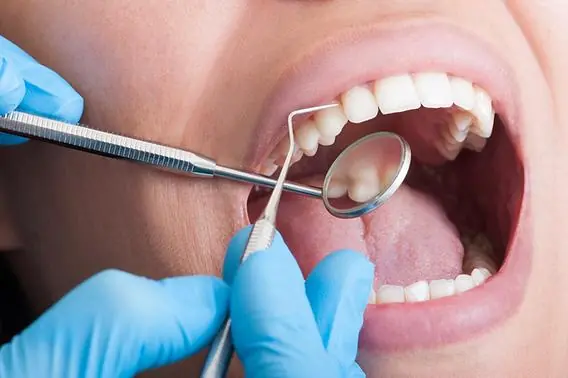 Could a Lump Inside the Mouth Be a Warning Sign? What You Should Know