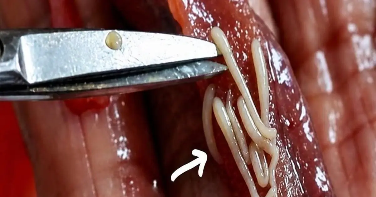 5 Common Foods That May Contain Parasites If Not Properly Prepared