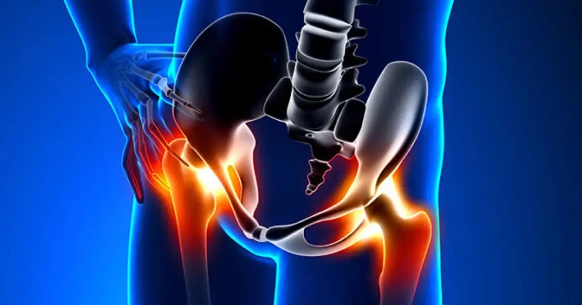 Your Aching Hip Could Be a Clue — Don’t Overlook These Possible Warning Signs