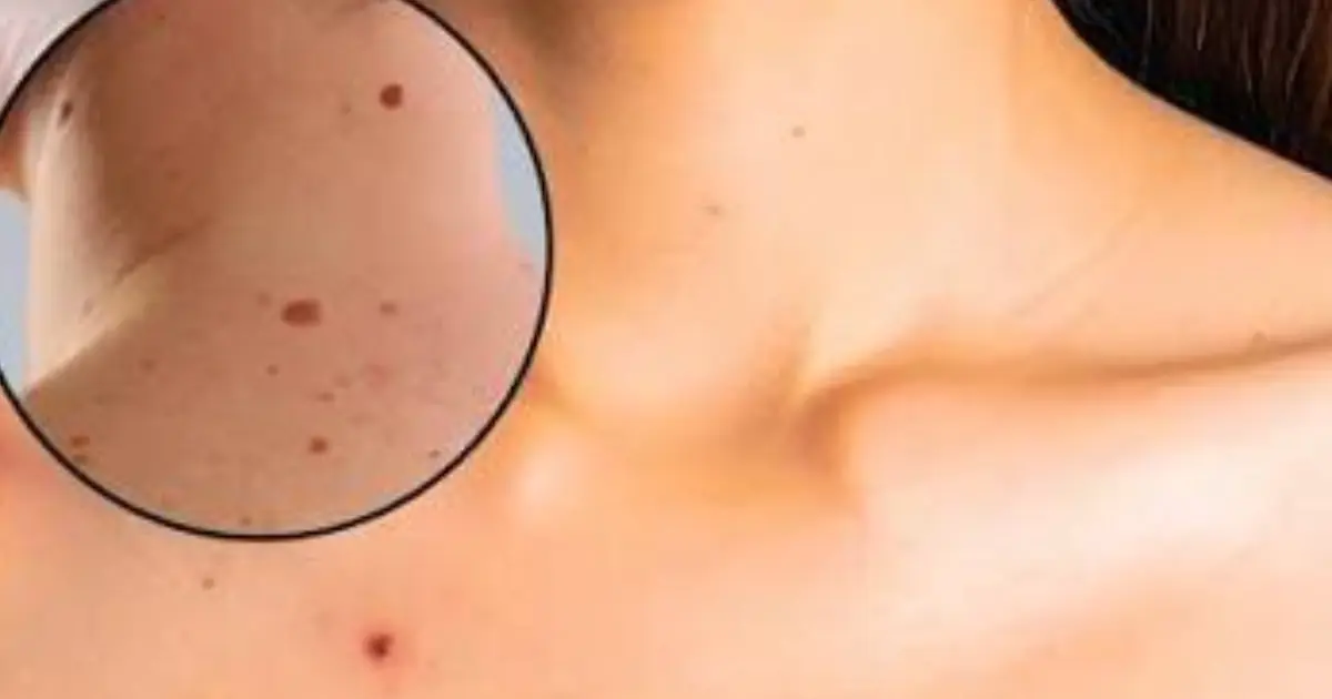 Red Dots You Shouldn’t Automatically Ignore — Here’s What They May Mean