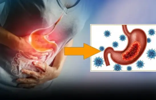 If Your Kidneys Are in Danger, Your Body Will Warn You With These 8 Signs