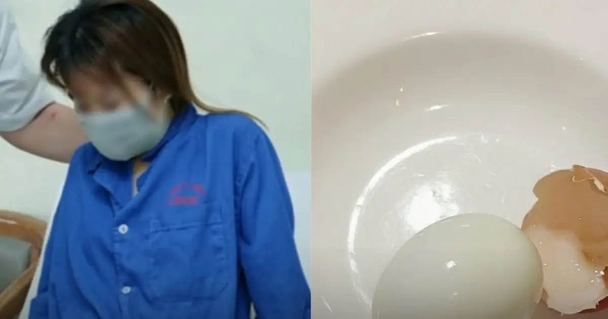 Trying to Lose Weight, She Ate Eggs at Every Meal for 5 Months. Her Medical Checkup Left Doctors Stunned