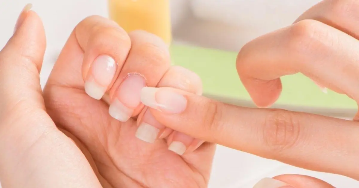 Observe Your Nails: 7 Warning Signs That May Indicate Underlying Health Problems