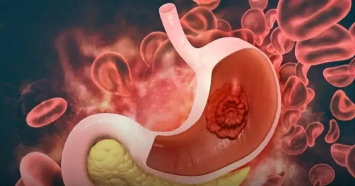 2 foods in your fridge doctors say you should throw away now