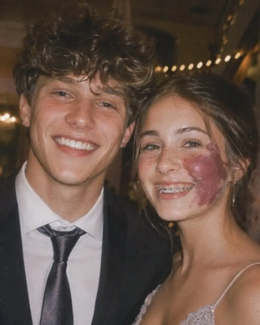 Only One Boy Asked Me To Prom Because Of My Birthmark—Until An Officer Walked In