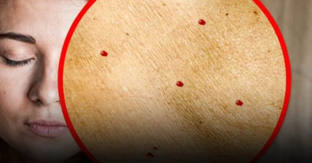 Tiny Red Dots on the Skin Can Sometimes Signal Hidden Health Problems