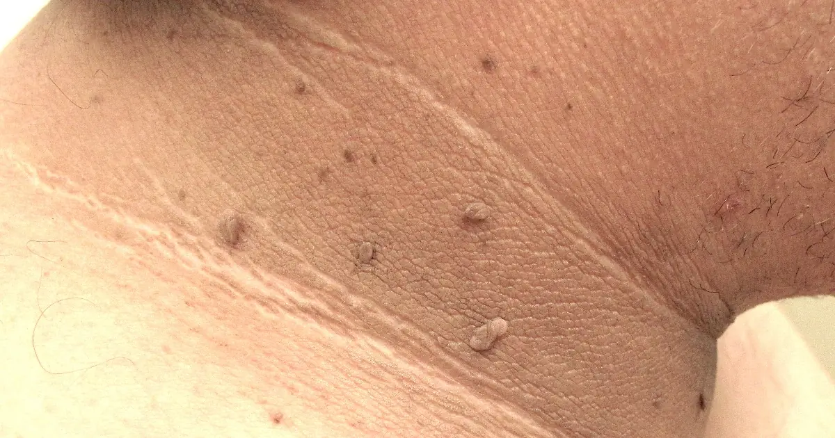 Skin Changes You Should Pay Attention To - Especially in These Areas
