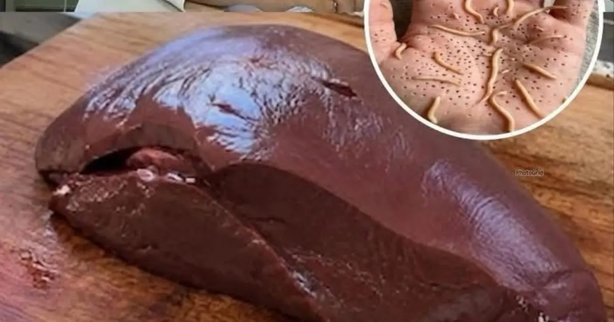 Doctors reveal that eating beef li.ver can cause…See more
