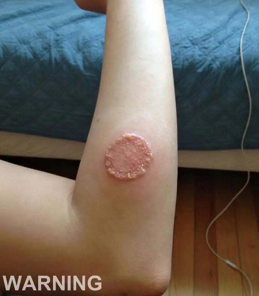 These are the consequences of sleeping with a...