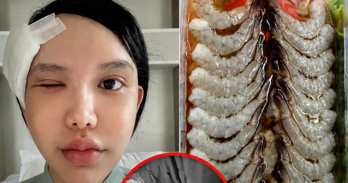 Woman Nearly Loses Vision After Eye Parasite Infection: Doctors Warn About Everyday Habits That Increase the Risk