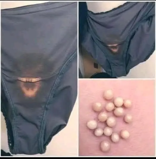 These Stains on Underwear Aren’t Always Normal Discharge: What Your Body May Be Trying to Tell You