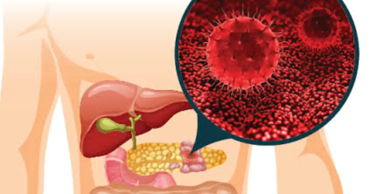 8 Subtle Signs Your Body May Show Before Pancreatic Cancer Is Diagnosed… Some Are Easy to Miss