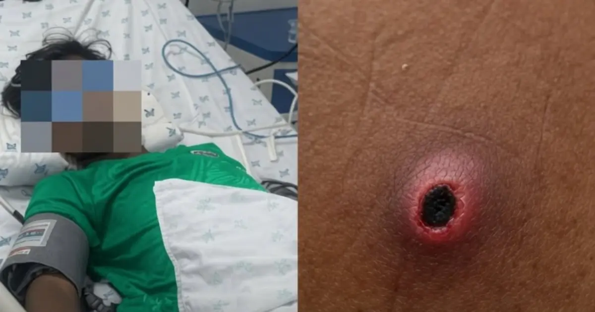 Doctor Lifted His Pant Leg, Then Ordered an Emergency ICU Transfer.