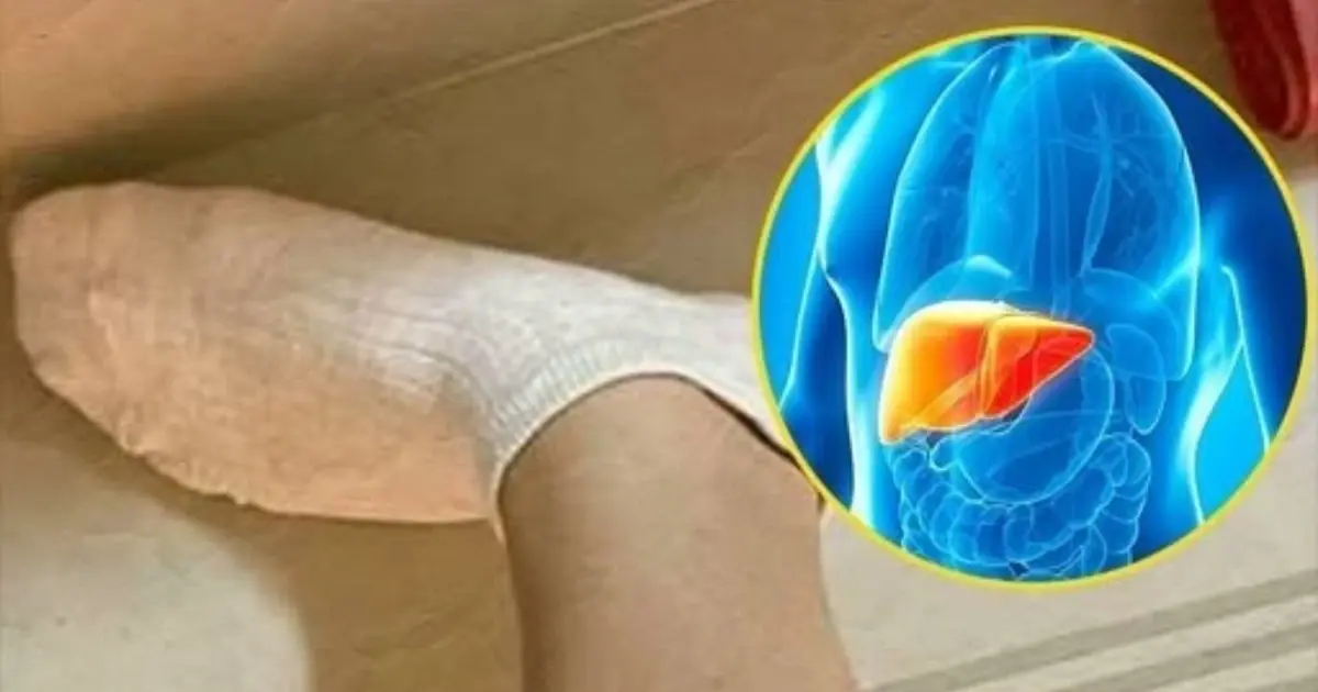 Your Feet Are a “Bl.ood Sug.ar Me.ter” – Beware of Diabetes If You Frequently Experience These 12 Symptoms