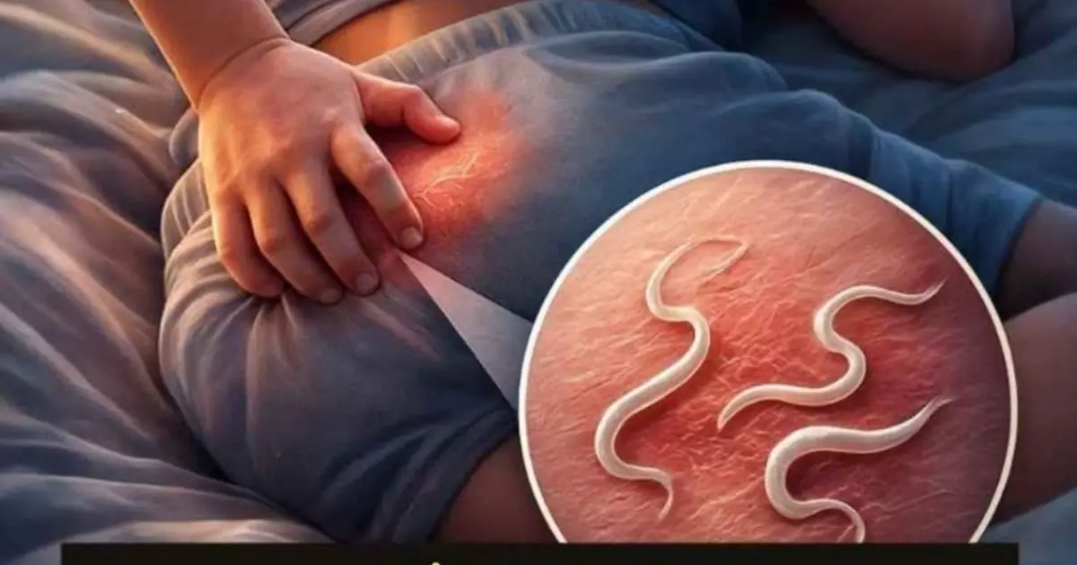 Pinworms in Children: What They Are and Why They Cause Nighttime Itching.