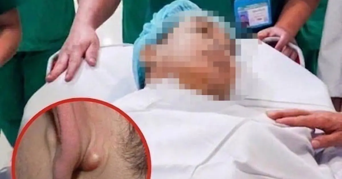 Young Man in His 20s D.i.es of C.anc.er After Ignoring Two Nighttime Symptoms
