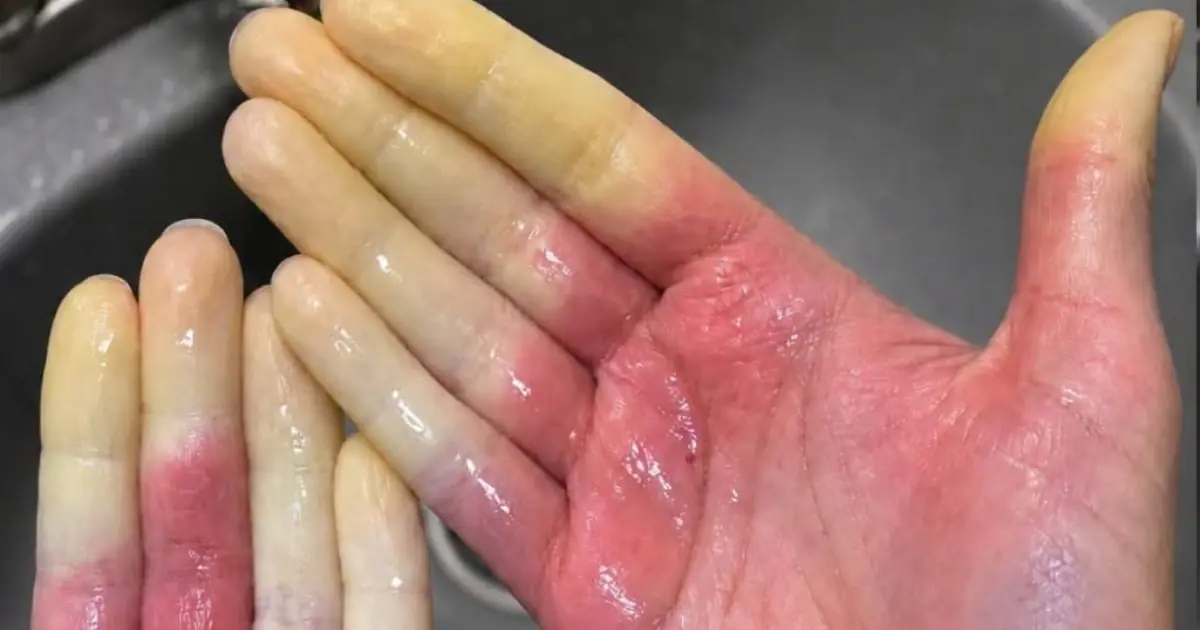 These are the consequences of sleeping with the…See more