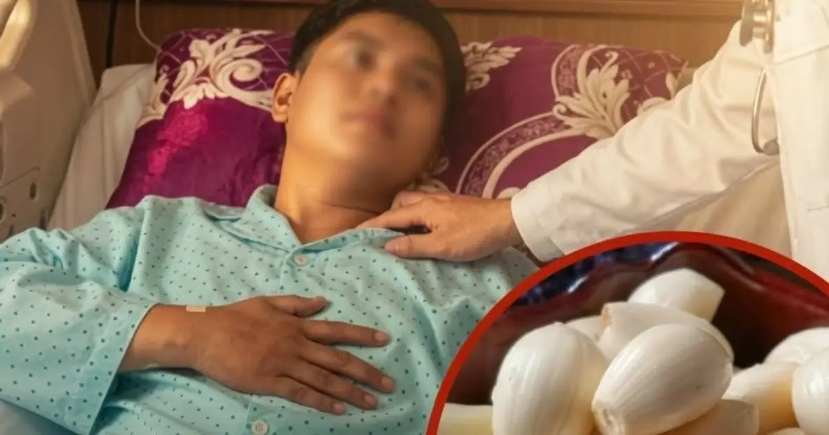 He Ate Garlic Every Day for 5 Months — What Happened to His Kidneys Surprised Doctors