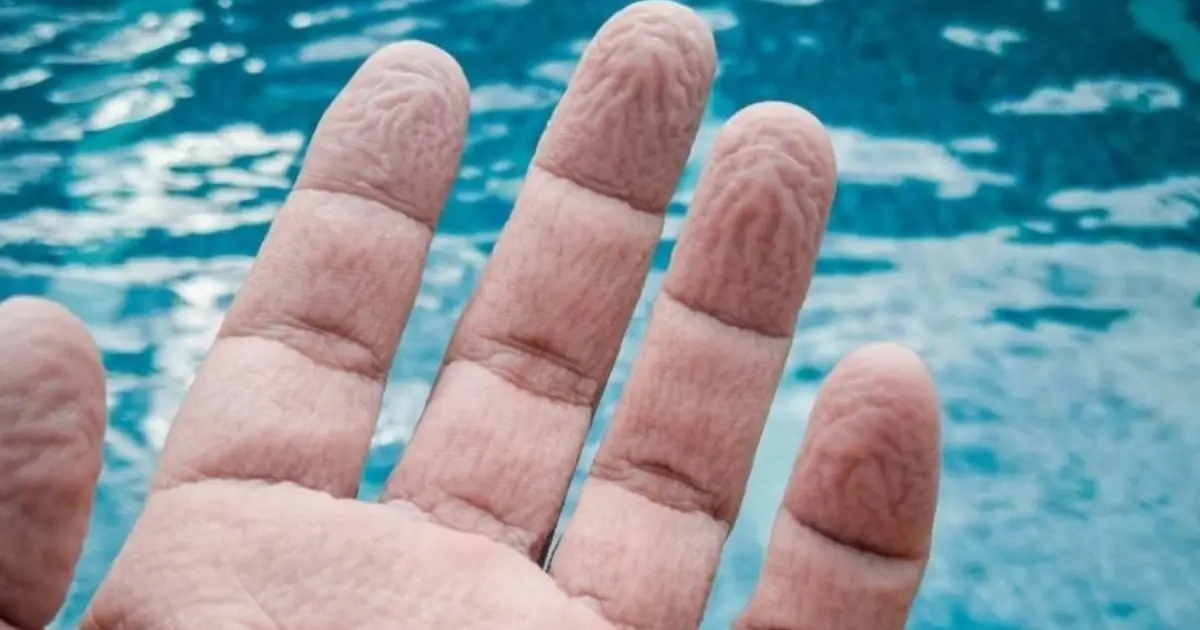 Wrinkled Fingers After Water Exposure: What Your Skin May Be Telling You