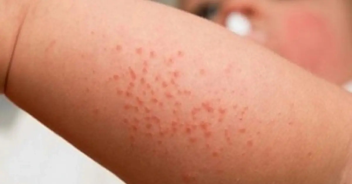 I Stayed at My Friend’s Old Apartment for a Few Days Then I Noticed These Strange Bumps