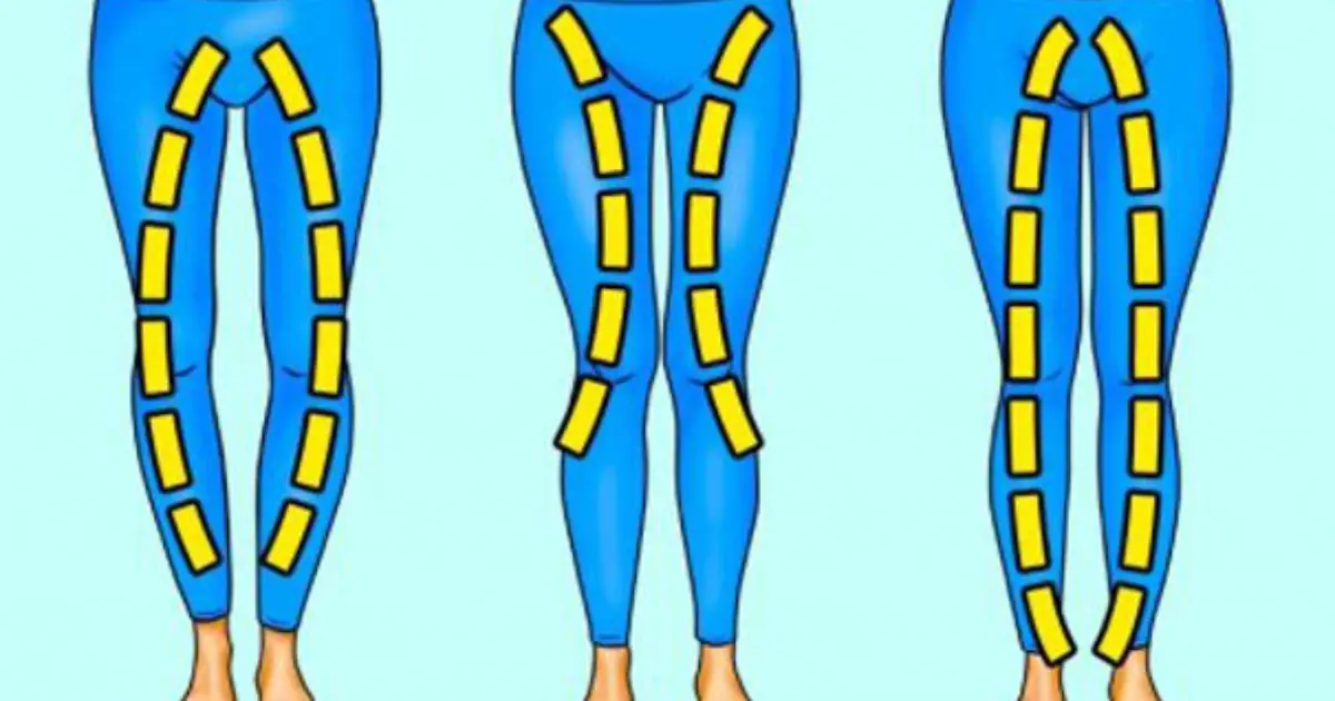 Your leg shape may reveal more about your body than you think