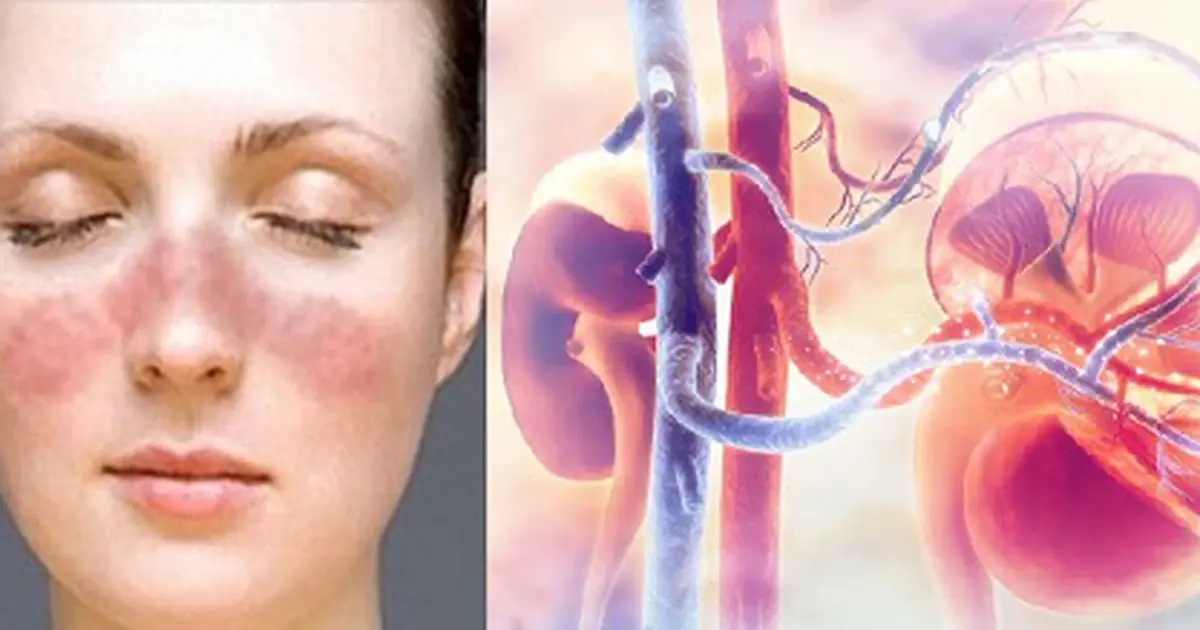 Kidney Failure Can Develop Quietly — 8 Warning Signs to Watch For