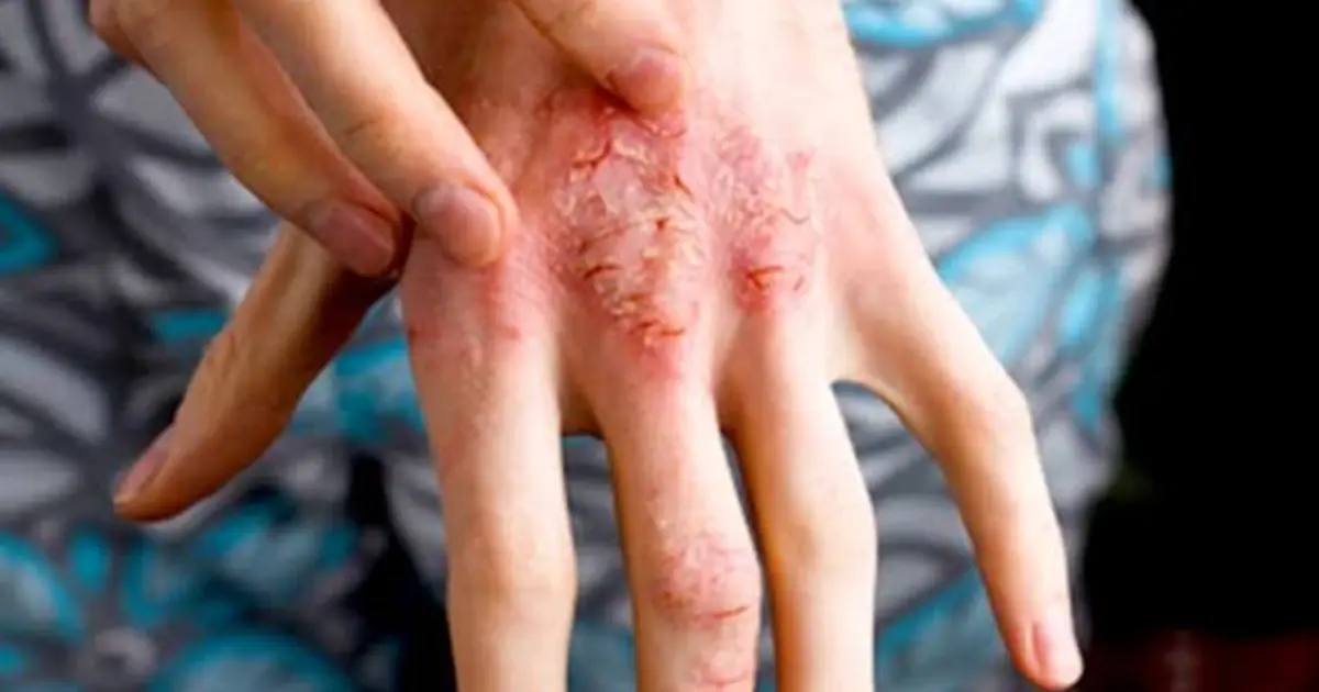 9 Strange Itching Patterns That Could Be Linked to Underlying Health Issues