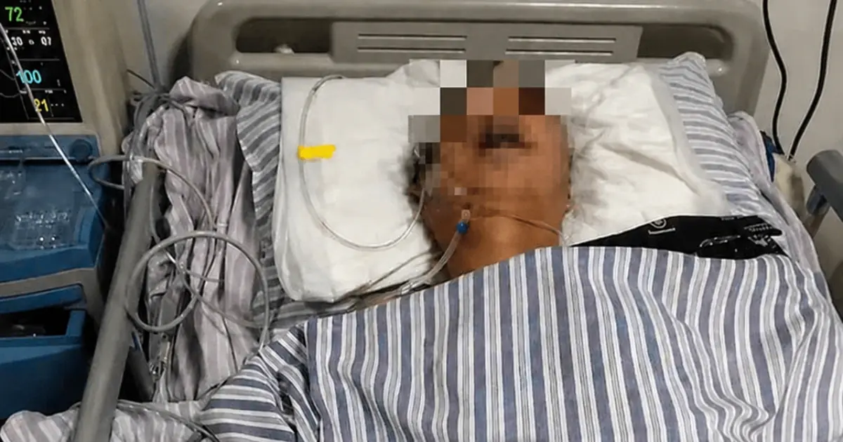 A 51-Year-Old Man Suddenly Suffered a Brain Stroke During a Family Dinner