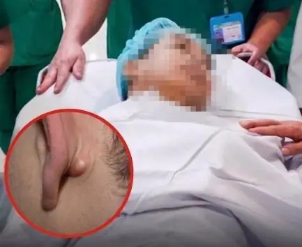 Young Man in His 20s D.i.es of C.anc.er After Ignoring Two Nighttime Symptoms