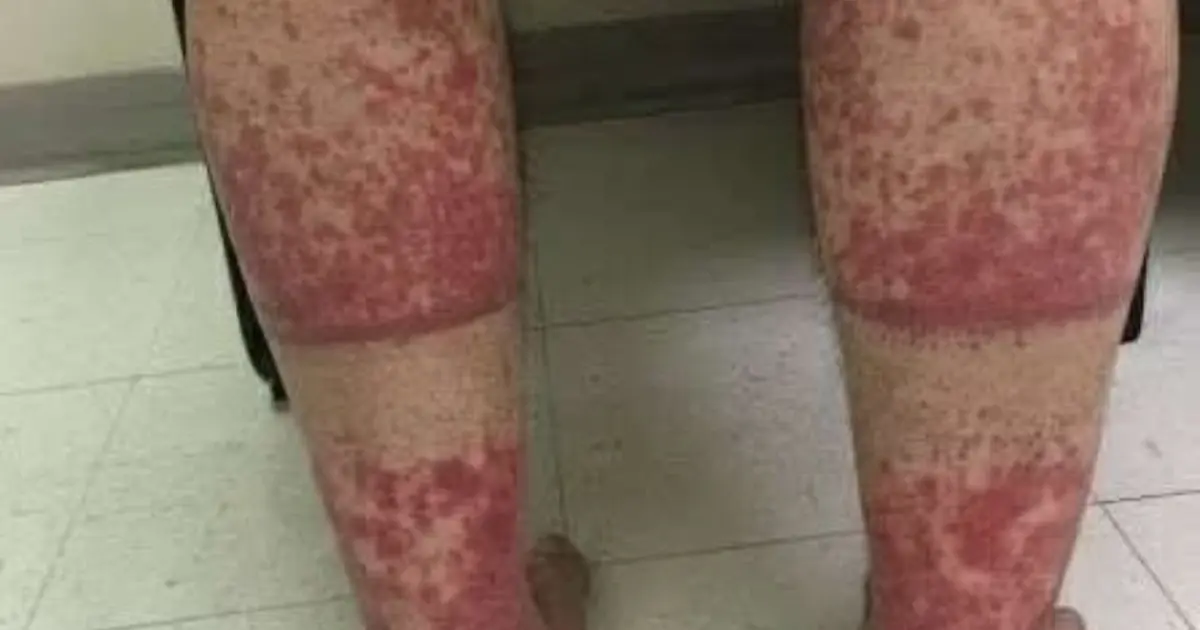 These are the consequences of sleeping with...